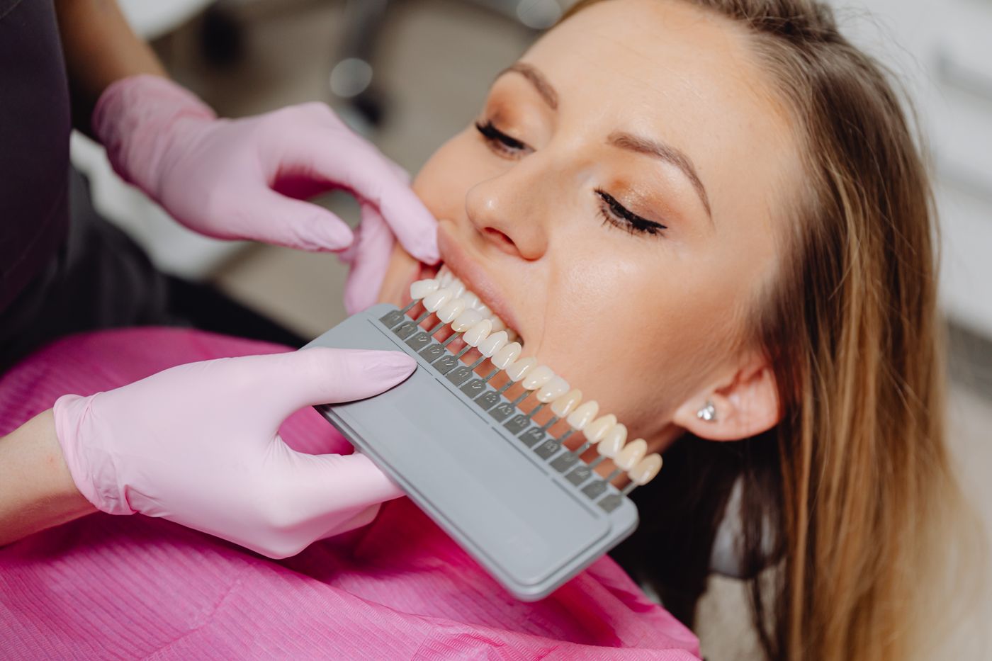 A dental shade guide held against a patient to match tooth colour